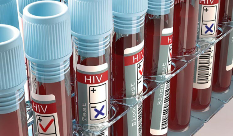 It was reported that Tripura has 828 students registered as HIV positive and 47 of them died. The state government has now issued a clarification